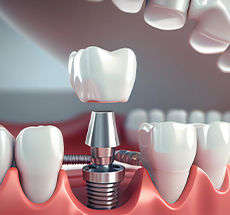 طراحی سایت دندانپزشکی